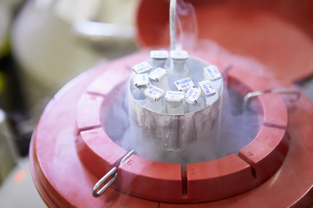 Male infertility and advanced andrology care at Ashalatha IVF Hospital Tirupati